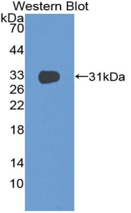 CD1E Antibody - Western blot of recombinant CD1E.