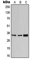 CD1E Antibody - Western blot analysis of CD1e expression in HeLa (A); SP2/0 (B); H9C2 (C) whole cell lysates.