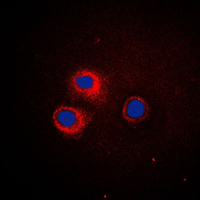 CD1E Antibody - Immunofluorescent analysis of CD1e staining in HeLa cells. Formalin-fixed cells were permeabilized with 0.1% Triton X-100 in TBS for 5-10 minutes and blocked with 3% BSA-PBS for 30 minutes at room temperature. Cells were probed with the primary antibody in 3% BSA-PBS and incubated overnight at 4 C in a humidified chamber. Cells were washed with PBST and incubated with a DyLight 594-conjugated secondary antibody (red) in PBS at room temperature in the dark. DAPI was used to stain the cell nuclei (blue).