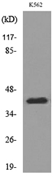CD1E Antibody - Western blot analysis of lysate from K562 cells, using CD1E Antibody.