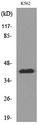 CD1E Antibody - Western blot analysis of lysate from K562 cells, using CD1E Antibody.
