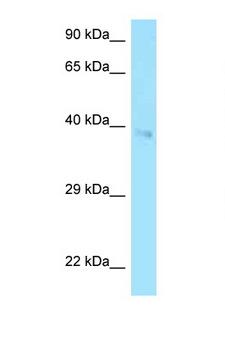 CD2 Antibody - CD2 antibody Western blot of HCT15 Cell lysate. Antibody concentration 1 ug/ml.  This image was taken for the unconjugated form of this product. Other forms have not been tested.