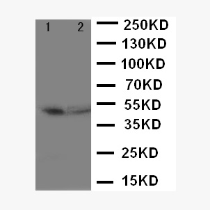 CD2 Antibody - WB of CD2 antibody. Lane 1: Rat Spleen Cell Lysate. Lane 2: NIH3T3 Cell Lysate..