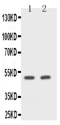 CD2 Antibody - Anti-CD2 antibody, Western blotting Lane 1: Rat Spleen Cell LysateLane 2: NIH/3T3 Cell Lysate