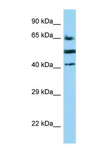 CD2 Antibody - CD2 antibody Western blot of COL0205 Cell lysate. Antibody concentration 1 ug/ml.  This image was taken for the unconjugated form of this product. Other forms have not been tested.