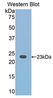 CD2 Antibody - Western Blot; Sample: Recombinant protein.