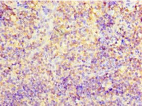 CD2 Antibody - Immunohistochemistry of paraffin-embedded human tonsil tissue using antibody at 1:100 dilution.  This image was taken for the unconjugated form of this product. Other forms have not been tested.