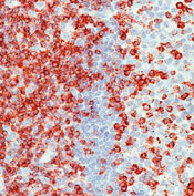 CD2 Antibody - Formalin-fixed, paraffin-embedded human tonsil stained with peroxidase-conjugate and AEC chromogen. Note membrane staining of T lymphocytes.