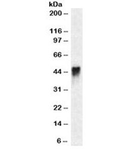 CD2 Antibody - Western blot testing of Jurkat cell lysate with CD2 antibody (clone HuLy-m1). Expected molecular weight ~47kDa.