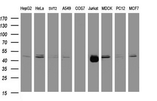 CD2 Antibody - Western blot of extracts (35ug) from 9 different cell lines by using anti-CD2 monoclonal antibody (HepG2: human; HeLa: human; SVT2: mouse; A549: human; COS7: monkey; Jurkat: human; MDCK: canine; PC12: rat; MCF7: human).