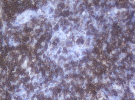 CD2 Antibody - IHC of paraffin-embedded Human tonsil using anti-CD2 mouse monoclonal antibody. (Heat-induced epitope retrieval by 10mM citric buffer, pH6.0, 120°C for 3min).