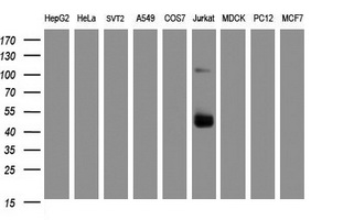 CD2 Antibody - Western blot of extracts (35 ug) from 9 different cell lines by using anti-CD2 monoclonal antibody (HepG2: human; HeLa: human; SVT2: mouse; A549: human; COS7: monkey; Jurkat: human; MDCK: canine; PC12: rat; MCF7: human).
