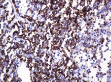 CD2 Antibody - IHC of paraffin-embedded Human lymph node tissue using anti-CD2 mouse monoclonal antibody.