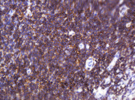 CD2 Antibody - IHC of paraffin-embedded Human tonsil using anti-CD2 mouse monoclonal antibody.