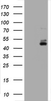 CD2 Antibody - HEK293T cells were transfected with the pCMV6-ENTRY control (Left lane) or pCMV6-ENTRY CD2 (Right lane) cDNA for 48 hrs and lysed. Equivalent amounts of cell lysates (5 ug per lane) were separated by SDS-PAGE and immunoblotted with anti-CD2.