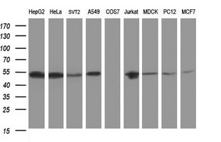 CD2 Antibody - Western blot of extracts (35 ug) from 9 different cell lines by using anti-CD2 monoclonal antibody (HepG2: human; HeLa: human; SVT2: mouse; A549: human; COS7: monkey; Jurkat: human; MDCK: canine; PC12: rat; MCF7: human).
