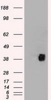 CD2 Antibody - HEK293T cells were transfected with the pCMV6-ENTRY control (Left lane) or pCMV6-ENTRY CD2 (Right lane) cDNA for 48 hrs and lysed. Equivalent amounts of cell lysates (5 ug per lane) were separated by SDS-PAGE and immunoblotted with anti-CD2.
