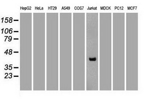 CD2 Antibody - Western blot analysis of extracts. (35ug) from 9 different cell lines by using anti-CD2 monoclonal antibody. (Clone UMAB6). (1:1000)