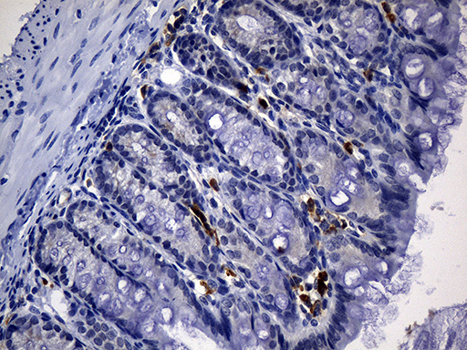 CD2 Antibody - Immunohistochemical staining of paraffin-embedded mouse colon tissue within the normal limits using anti-CD2 mouse monoclonal antibody. (Heat-induced epitope retrieval by 1mM EDTA in 10mM Tris buffer. (pH8.5) at 120°C for 3 min. (1:500)