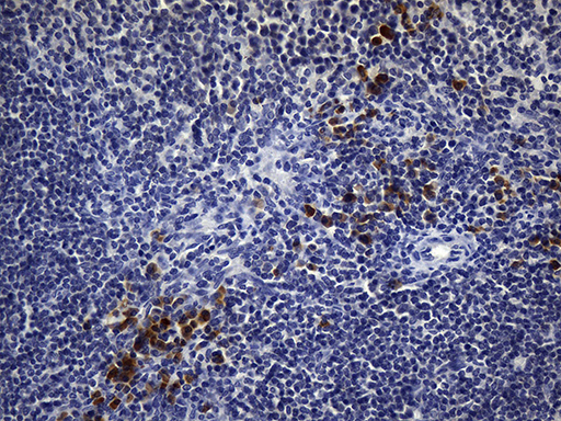 CD2 Antibody - Immunohistochemical staining of paraffin-embedded mouse spleen tissue using anti-CD2 clone UMAB6 mouse monoclonal antibody. (Heat-induced epitope retrieval by 1mM EDTA in 10mM Tris buffer. (pH8.5) at 120 oC for 3 min. (1:500).