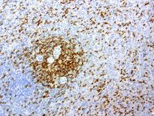 CD2 Antibody - IHC staining of FFPE human spleen using anti-CD2 clone UMAB6 mouse monoclonal antibody at 1:200 and detection with Polink2 Broad HRP DAB.requires heat-induced epitope retrieval with Citrate pH6.O. The image shows strong membranous and cytoplasmic staining.