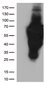 CD2 Antibody - Western Blot analysis of extracts. (35µg) from 10 different cell lines by using anti-CD2 monoclonal antibody. (Clone UMAB86)