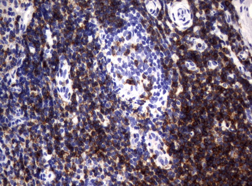 CD2 Antibody - Immunohistochemical staining of paraffin-embedded Human tonsil using anti-CD2 mouse monoclonal antibody.  heat-induced epitope retrieval by 10mM citric buffer, pH6.0, 120C for 3min)