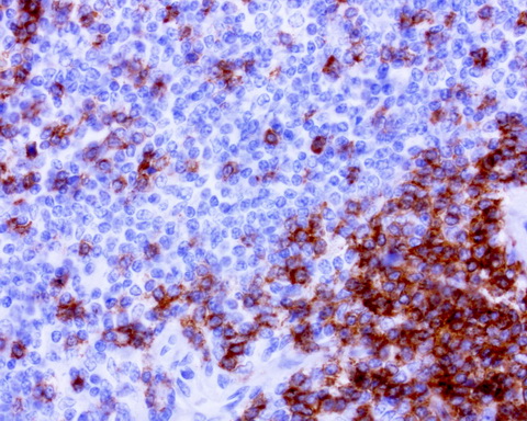 CD2 Antibody - Immunohistochemical staining of paraffin-embedded human spleen using anti-CD2 mouse monoclonal antibody at 1: 200 dilution of 1mg/mL using Polink2 Broad HRP DAB for detection.requires HIER with citrate pH6.0 at 110C for 3 min using pressure chamber/cooker. The image shows strong cytoplamic and membrane staining.