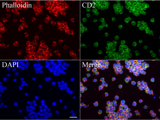CD2 Antibody - Immunofluorescent staining of Jurkat cells using anti-CD2 mouse monoclonal antibody  green, 1:100). Actin filaments were labeled with Alexa Fluor® 594 Phalloidin. (red), and nuclear with DAPI. (blue). Scale bar, 20µm.