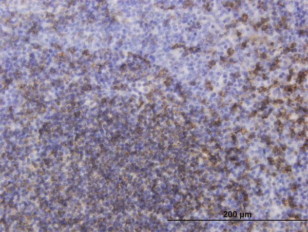 CD20 Antibody - Immunoperoxidase of monoclonal antibody to MS4A1 on formalin-fixed paraffin-embedded human tonsil. [antibody concentration 3 ug/ml]