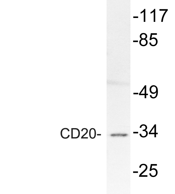 CD20 Antibody - Western blot analysis of lysate from A549 cells, using CD20 antibody.