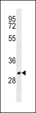 CD20 Antibody - MS4A1 Antibody western blot of HL-60 cell line lysates (35 ug/lane). The MS4A1 antibody detected the MS4A1 protein (arrow).