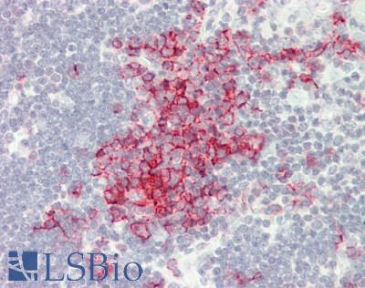 CD20 Antibody - Mouse Thymus: Formalin-Fixed, Paraffin-Embedded (FFPE).  This image was taken for the unconjugated form of this product. Other forms have not been tested.