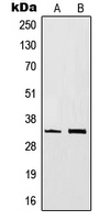 CD20 Antibody - Western blot analysis of CD20 expression in BJAB (A); Ramos (B) whole cell lysates.