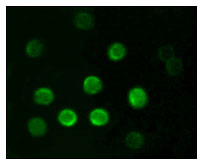 CD20 Antibody - Immunofluorescence of B lymphocytes using CD20 mouse monoclonal antibody.