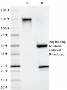 CD20 Antibody - SDS-PAGE Analysis of Purified, BSA-Free CD20 Antibody (clone 93-1B3). Confirmation of Integrity and Purity of the Antibody.