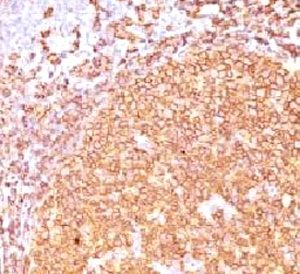 CD20 Antibody - IHC testing of CD20 antibody and FFPE human tonsil tissue.  This image was taken for the unmodified form of this product. Other forms have not been tested.