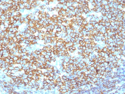 CD20 Antibody - Formalin-fixed, paraffin-embedded human Tonsil stained with CD20 Rabbit Recombinant Monoclonal Antibody (IGEL/1497R).