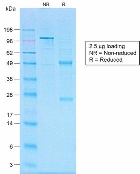 CD20 Antibody - SDS-PAGE Analysis of Purified CD20 Rabbit Recombinant Monoclonal Antibody (IGEL/1497R). Confirmation of Purity and Integrity of Antibody.