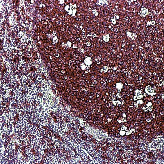 CD20 Antibody - Formalin-fixed, paraffin-embedded human tonsil stained with CD20, B cell antibody.