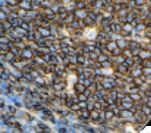 CD20 Antibody - IHC of CD20 on FFPE Colon tissue. This image was taken for the unmodified form of this product. Other forms have not been tested.
