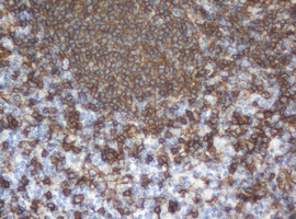 CD20 Antibody - IHC of paraffin-embedded Human tonsil using anti-MS4A1 mouse monoclonal antibody.