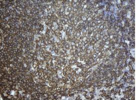 CD20 Antibody - IHC of paraffin-embedded lymph node tissue using anti-MS4A1 mouse monoclonal antibody. (Dilution 1:100).