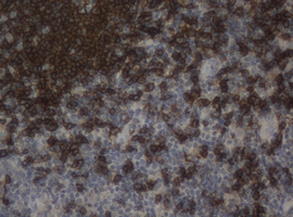 CD20 Antibody - IHC of paraffin-embedded Human tonsil using anti-MS4A1 mouse monoclonal antibody. (Heat-induced epitope retrieval by 10mM citric buffer, pH6.0, 100C for 10min).