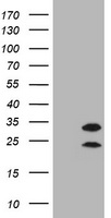 CD20 Antibody - HEK293T cells were transfected with the pCMV6-ENTRY control (Left lane) or pCMV6-ENTRY MS4A1 (Right lane) cDNA for 48 hrs and lysed. Equivalent amounts of cell lysates (5 ug per lane) were separated by SDS-PAGE and immunoblotted with anti-MS4A1.