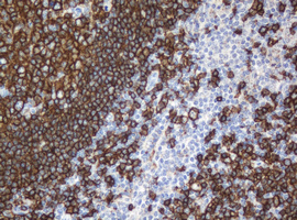 CD20 Antibody - IHC of paraffin-embedded Human tonsil using anti-MS4A1 mouse monoclonal antibody.