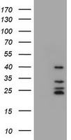 CD20 Antibody - HEK293T cells were transfected with the pCMV6-ENTRY control (Left lane) or pCMV6-ENTRY MS4A1 (Right lane) cDNA for 48 hrs and lysed. Equivalent amounts of cell lysates (5 ug per lane) were separated by SDS-PAGE and immunoblotted with anti-MS4A1.