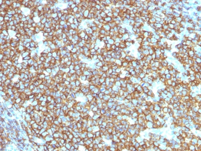 CD20 Antibody - Formalin-fixed, paraffin-embedded human Tonsil stained with CD20 Mouse Recombinant Monoclonal Antibody (rIGEL/773).