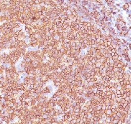 CD20 Antibody - IHC testing of anti-CD20 antibody and FFPE human tonsil tissue.  This image was taken for the unmodified form of this product. Other forms have not been tested.