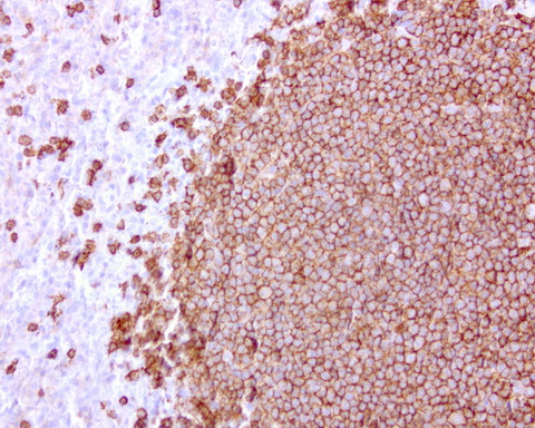 CD20 Antibody - Immunohistochemical staining of paraffin-embedded human spleen using anti-CD20 mouse monoclonal antibody at 1:200 dilution of 1.0 mg/mL using Polink2 Broad HRP DAB for detection.requires HIER with with citrate pH6.0 at 110C for 3 min using pressure chamber/cooker. The spleen shows strong membrane and cytoplasmic staining in red and white pulp cells.